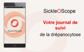 Visualisez le tutoriel de l'application - SickleOScope