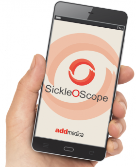 Welcome to our website - SickleOScope